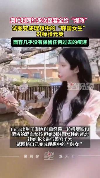 澳彩龙门客栈:想变韩女全脸整容